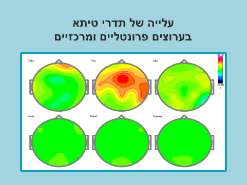 QEEG